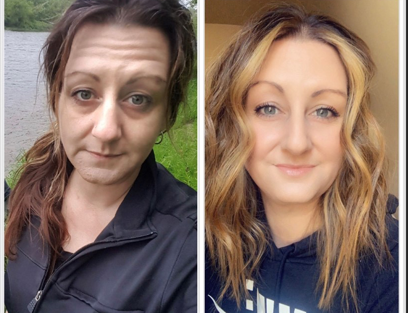 Molly - Before and After Recovery